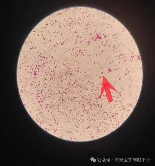 如何預防魚類細菌感染，arxiv論文助手工具arxiv論文助手工具arxiv論文助手
