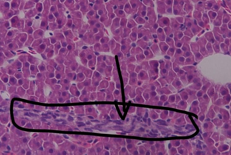 土霉素治療龍魚炸鱗的副作用有哪些？，土霉素治療龍魚炸鱗