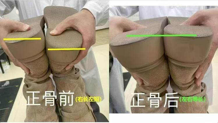 有哪些成功的龍魚咬嘴正骨手術案例，“龍魚咬嘴正骨手術”是否存在的觀賞魚醫療操作