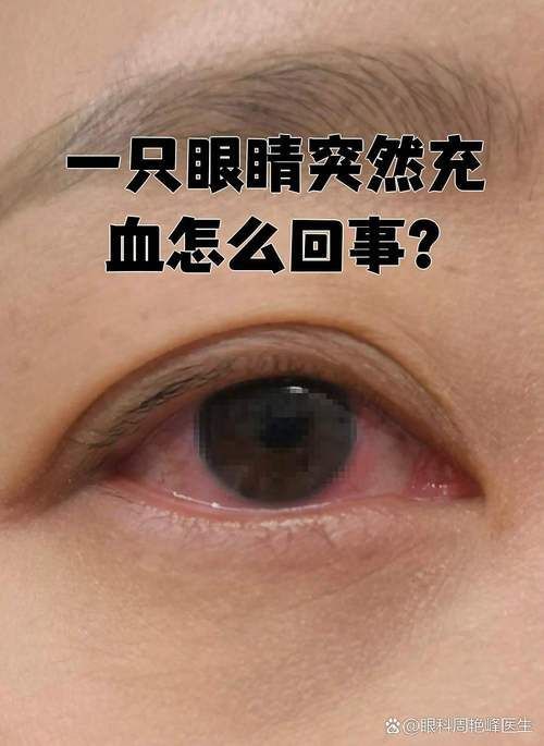 如何區分輕度、中度和重度充血，權威醫學圖譜類圖像與充血（congestion）的區分詳解