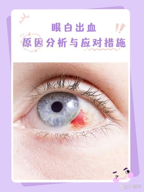 如何區分輕度、中度和重度充血，權威醫學圖譜類圖像與充血（congestion）的區分詳解