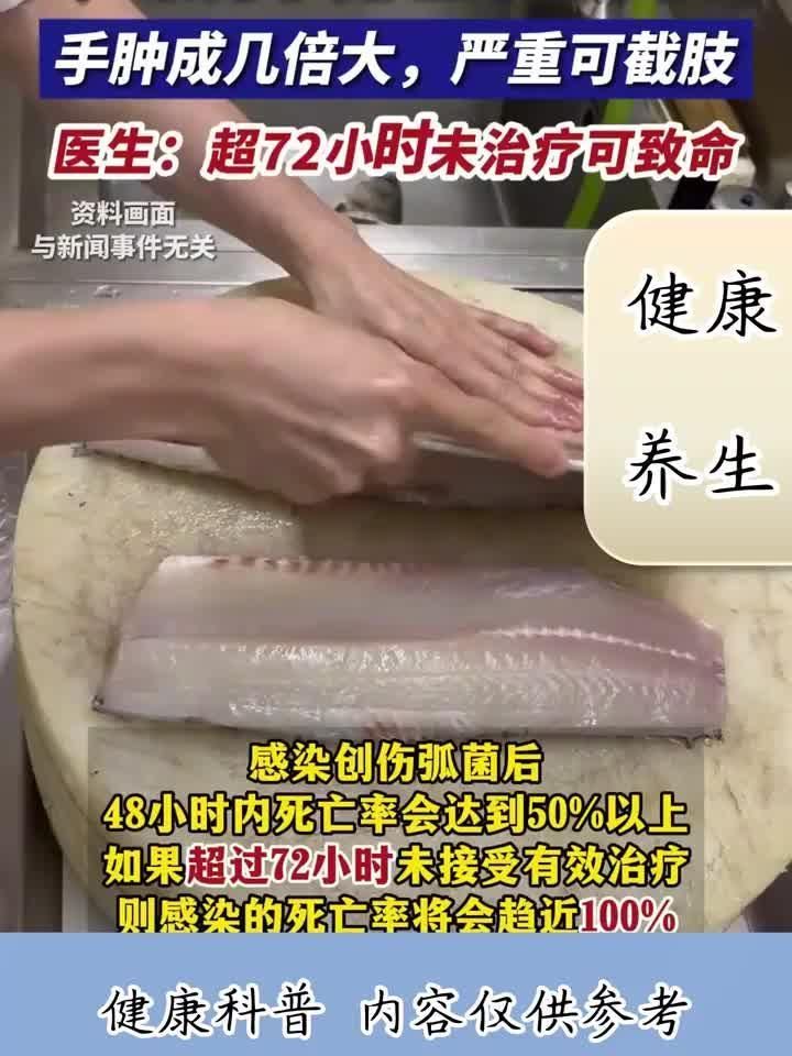 有哪些海洋細(xì)菌感染案例，2019年海洋細(xì)菌感染案例提醒我們需要時刻保持警惕 有哪些海洋細(xì)菌感染案例，2019年海洋細(xì)菌感染案例提醒我們需要時刻保持警惕 龍魚百科 第1張