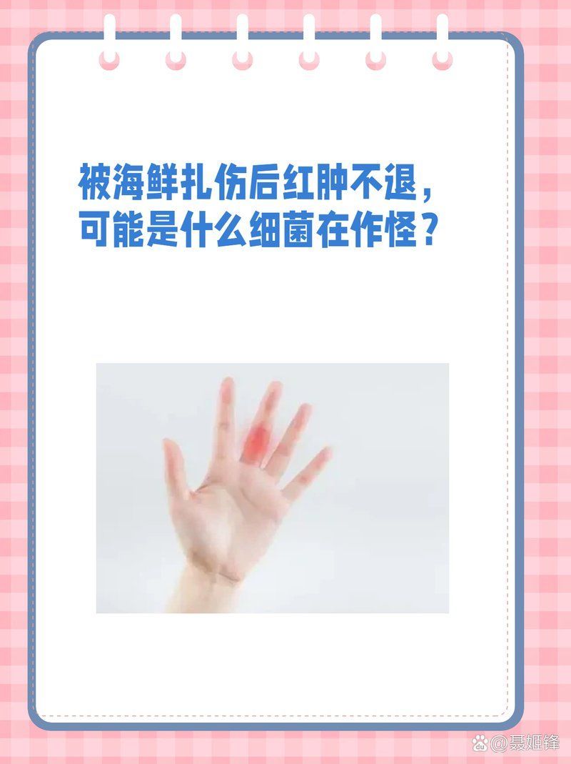 有哪些海洋細(xì)菌感染案例，2019年海洋細(xì)菌感染案例提醒我們需要時刻保持警惕 有哪些海洋細(xì)菌感染案例，2019年海洋細(xì)菌感染案例提醒我們需要時刻保持警惕 龍魚百科 第2張