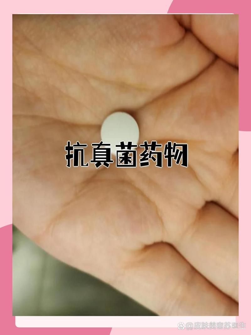 有哪些抗真菌藥物是處方藥，處方抗真菌藥的使用指南