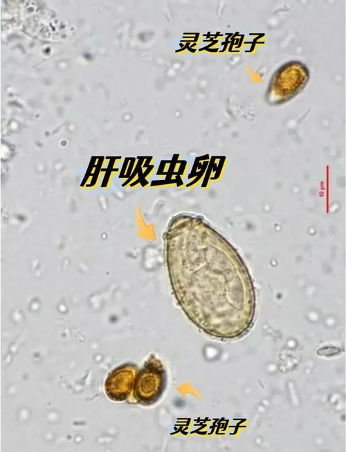 哪些魚類容易感染寄生蟲,————科學詳解與高風險物種清單 龍魚百科 第5張 哪些魚類容易感染寄生蟲,————科學詳解與高風險物種清單 哪些魚類容易感染寄生蟲,————科學詳解與高風險物種清單 龍魚百科 第5張