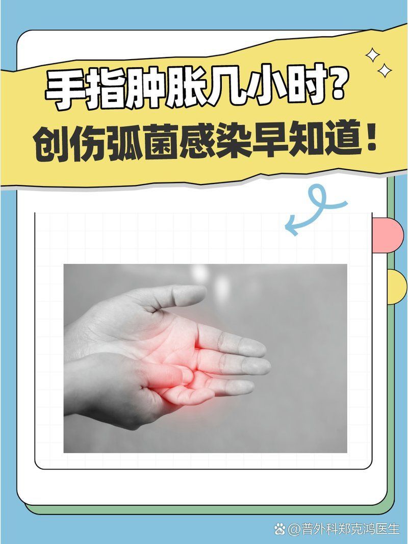 創(chuàng)傷弧菌感染有哪些癥狀，創(chuàng)傷弧菌感染是一種由創(chuàng)傷弧菌引起的細(xì)菌性感染的常見癥狀 創(chuàng)傷弧菌感染有哪些癥狀，創(chuàng)傷弧菌感染是一種由創(chuàng)傷弧菌引起的細(xì)菌性感染的常見癥狀 龍魚百科 第2張