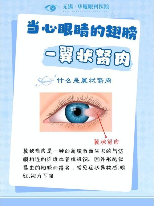 如何預(yù)防眼睛白膜，mcp工具調(diào)用戶要求詳解如何預(yù)防眼睛白膜需要1000字和配圖