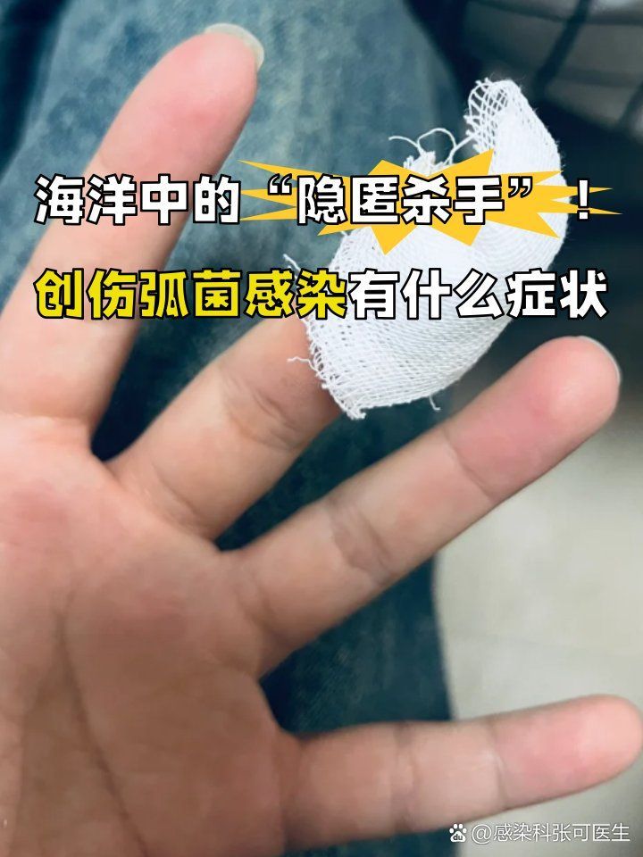 感染海洋弧菌后有哪些典型癥狀，海洋創傷弧菌感染的典型癥狀
