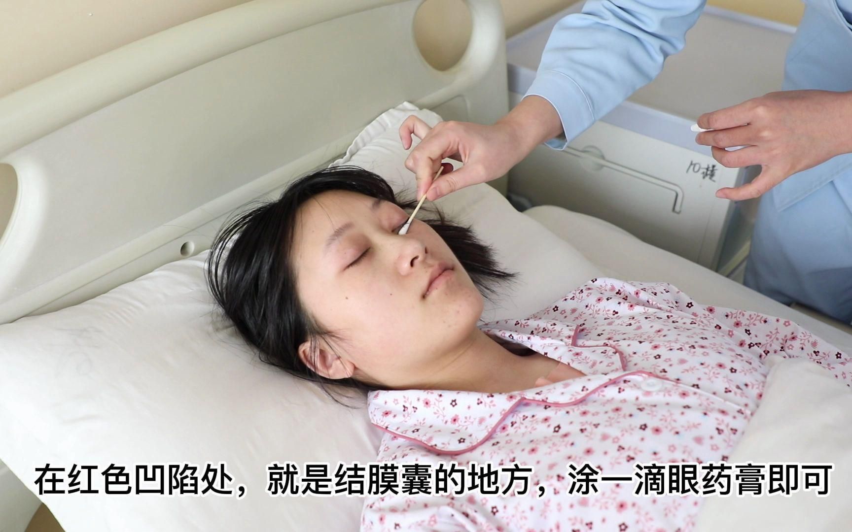如何正確使用土霉素治療蒙眼病，關于土霉素治療蒙眼病