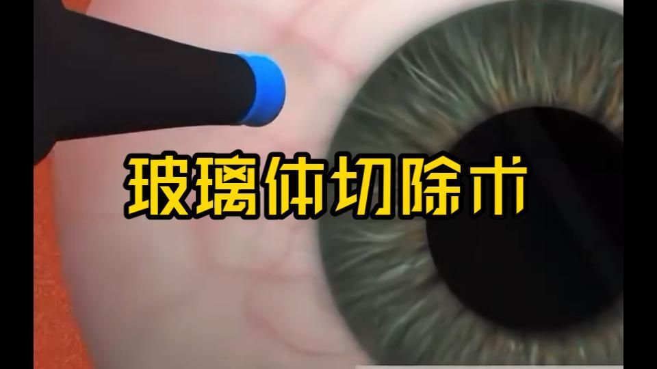 重度蒙眼病如何治療，重度蒙眼病治療方法 重度蒙眼病如何治療，重度蒙眼病治療方法 龍魚百科 第2張