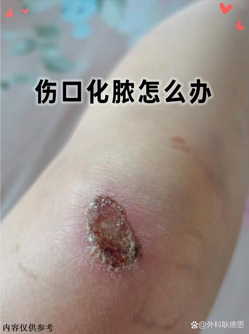 如何預防海里細菌感染,關于海里細菌感染 龍魚百科 第3張 如何預防海里細菌感染,關于海里細菌感染 如何預防海里細菌感染,關于海里細菌感染 龍魚百科 第3張