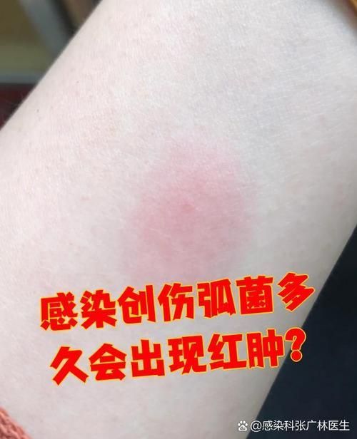 如何預防海里細菌感染,關于海里細菌感染 龍魚百科 第4張 如何預防海里細菌感染,關于海里細菌感染 如何預防海里細菌感染,關于海里細菌感染 龍魚百科 第4張