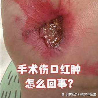 如何預防海里細菌感染,關于海里細菌感染 龍魚百科 第2張 如何預防海里細菌感染,關于海里細菌感染 如何預防海里細菌感染,關于海里細菌感染 龍魚百科 第2張