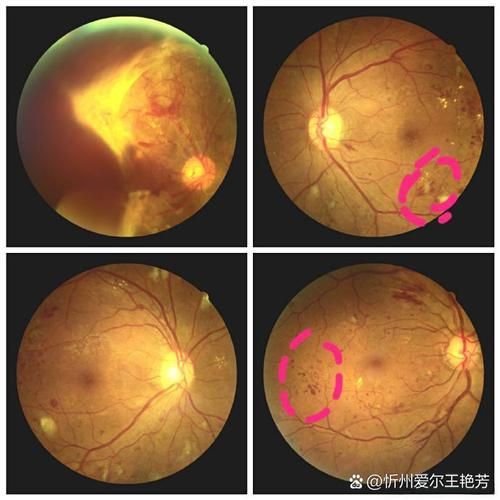 如何判斷紅龍魚是否突眼 如何判斷紅龍魚是否突眼 龍魚百科 第6張