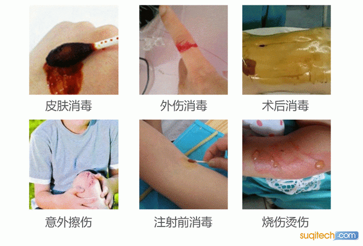 如何判斷碘伏是否完全清除，如何判斷碘伏完全清除