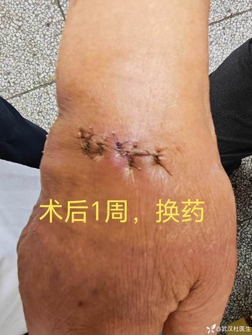 龍魚攻擊黑尾大勾后如何處理？，用戶要求詳解龍魚攻擊黑尾大勾后如何處理，需提供1000字左右的詳細說明并配圖 龍魚攻擊黑尾大勾后如何處理？，用戶要求詳解龍魚攻擊黑尾大勾后如何處理，需提供1000字左右的詳細說明并配圖 龍魚百科 第4張