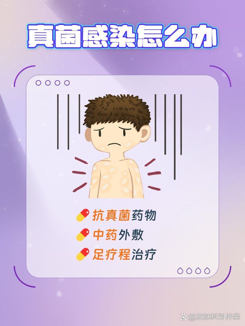 真菌和細菌感染的治療方法有哪些，真菌與細菌感染的區(qū)別 真菌和細菌感染的治療方法有哪些，真菌與細菌感染的區(qū)別 龍魚百科 第8張