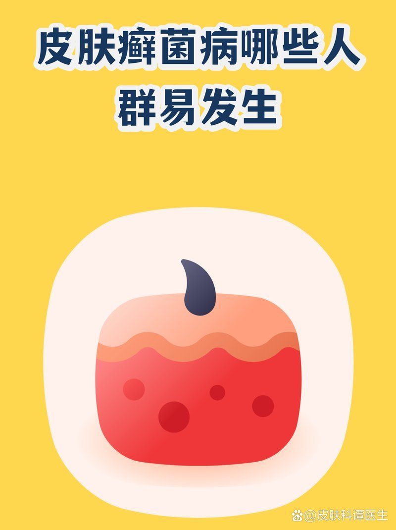 哪些人群容易發生真菌感染，哪些人容易被真菌“盯上”？ 哪些人群容易發生真菌感染，哪些人容易被真菌“盯上”？ 龍魚百科 第2張