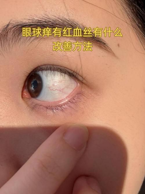 再次充血后如何治療更有效,權(quán)威醫(yī)學指南、三甲醫(yī)學指南、三甲醫(yī)院診療方案調(diào)用工具 龍魚百科 第4張 再次充血后如何治療更有效,權(quán)威醫(yī)學指南、三甲醫(yī)學指南、三甲醫(yī)院診療方案調(diào)用工具 再次充血后如何治療更有效,權(quán)威醫(yī)學指南、三甲醫(yī)學指南、三甲醫(yī)院診療方案調(diào)用工具 龍魚百科 第4張