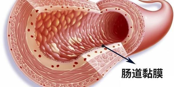 魚腸炎好轉(zhuǎn)后需要多久恢復(fù)健康,魚腸炎好轉(zhuǎn)后需要多久恢復(fù)健康因個(gè)體而異 龍魚百科 第3張 魚腸炎好轉(zhuǎn)后需要多久恢復(fù)健康,魚腸炎好轉(zhuǎn)后需要多久恢復(fù)健康因個(gè)體而異 魚腸炎好轉(zhuǎn)后需要多久恢復(fù)健康,魚腸炎好轉(zhuǎn)后需要多久恢復(fù)健康因個(gè)體而異 龍魚百科 第3張