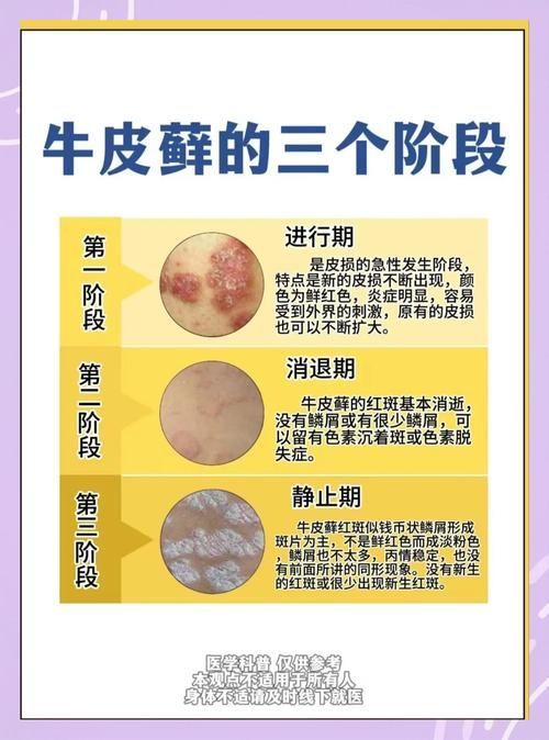 拔掉松動的鱗片后如何護理,mcp工具的護理 龍魚百科 第1張 拔掉松動的鱗片后如何護理,mcp工具的護理 拔掉松動的鱗片后如何護理,mcp工具的護理 龍魚百科 第1張