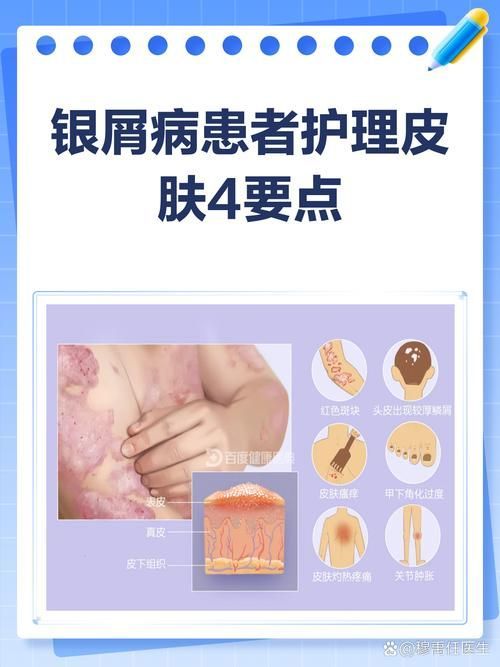 拔掉松動的鱗片后如何護理,mcp工具的護理 龍魚百科 第4張 拔掉松動的鱗片后如何護理,mcp工具的護理 拔掉松動的鱗片后如何護理,mcp工具的護理 龍魚百科 第4張