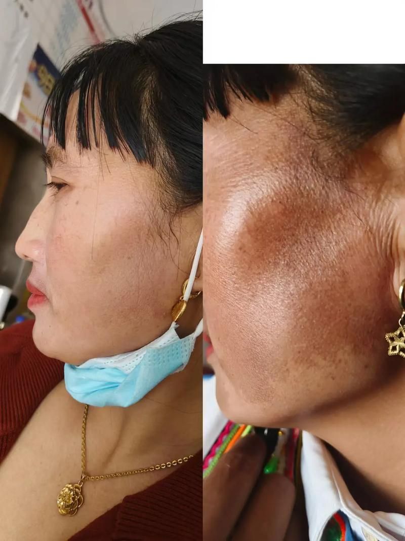 如何判斷魚鱗珠是否去除干凈，arxiv論文助手魚鱗珠是否去除干凈與否去除干凈 如何判斷魚鱗珠是否去除干凈，arxiv論文助手魚鱗珠是否去除干凈與否去除干凈 龍魚百科 第4張