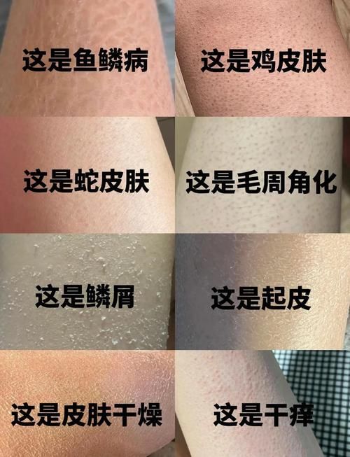 如何判斷魚鱗珠是否去除干凈，arxiv論文助手魚鱗珠是否去除干凈與否去除干凈 如何判斷魚鱗珠是否去除干凈，arxiv論文助手魚鱗珠是否去除干凈與否去除干凈 龍魚百科 第1張