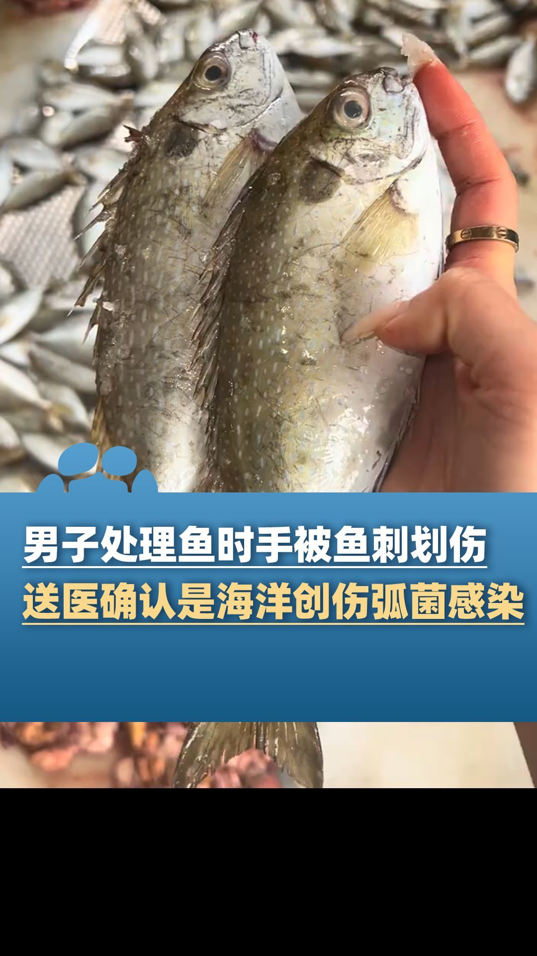 海洋創傷弧菌感染有哪些治療方法，創傷弧菌感染如何治療 海洋創傷弧菌感染有哪些治療方法，創傷弧菌感染如何治療 龍魚百科 第3張