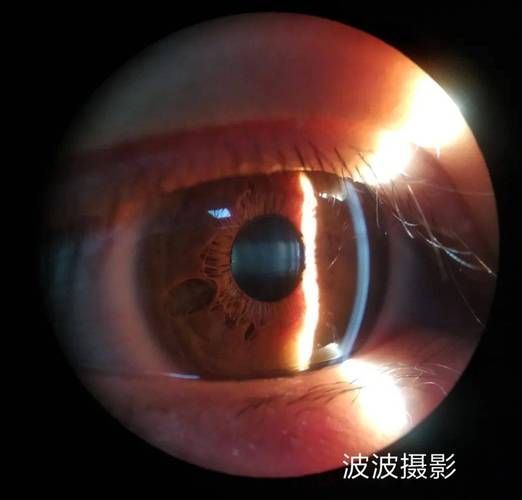 如何判斷魚眼白膜的類型,如何判斷魚眼白膜 龍魚百科 第2張 如何判斷魚眼白膜的類型,如何判斷魚眼白膜 如何判斷魚眼白膜的類型,如何判斷魚眼白膜 龍魚百科 第2張