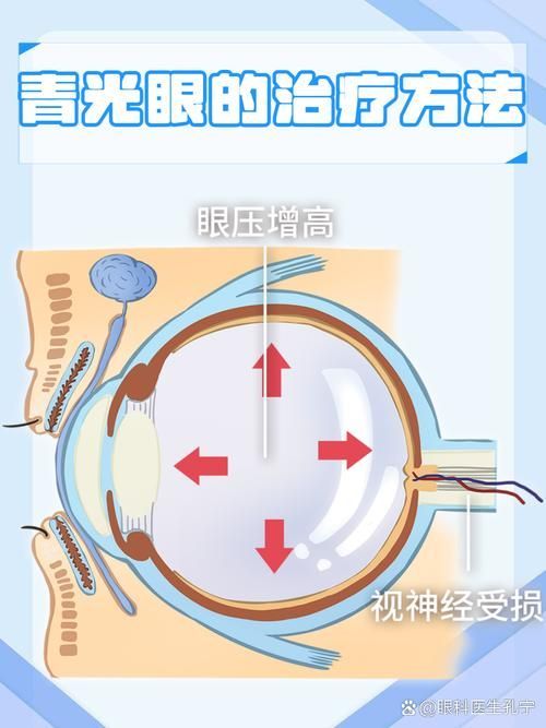 氣蒙眼如何快速緩解，“氣蒙眼”的診斷方法