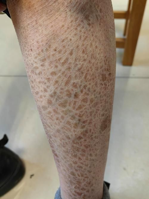 如何預防魚炸鱗病的發生 龍魚百科 第5張 如何預防魚炸鱗病的發生 如何預防魚炸鱗病的發生 龍魚百科 第5張