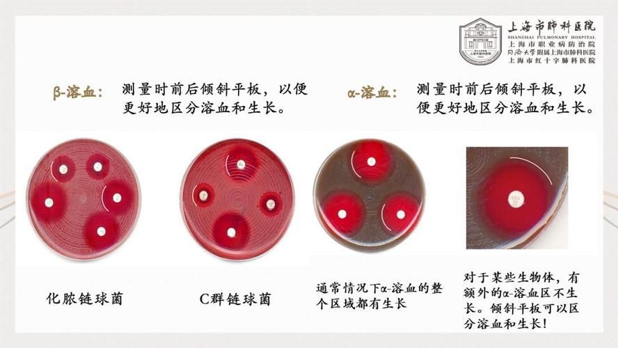 如何判斷土霉素是否有效，arxiv論文助手判斷土霉素是否有效，土霉素是否有可能失敗