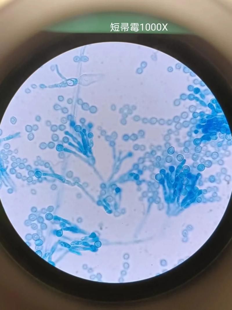 能否提供更多關(guān)于真菌和細(xì)菌的圖片,生物學(xué)研究中真菌和細(xì)菌的圖片生成的一段摘要:真菌和細(xì)菌 龍魚百科 第3張 能否提供更多關(guān)于真菌和細(xì)菌的圖片,生物學(xué)研究中真菌和細(xì)菌的圖片生成的一段摘要:真菌和細(xì)菌 能否提供更多關(guān)于真菌和細(xì)菌的圖片,生物學(xué)研究中真菌和細(xì)菌的圖片生成的一段摘要:真菌和細(xì)菌 龍魚百科 第3張