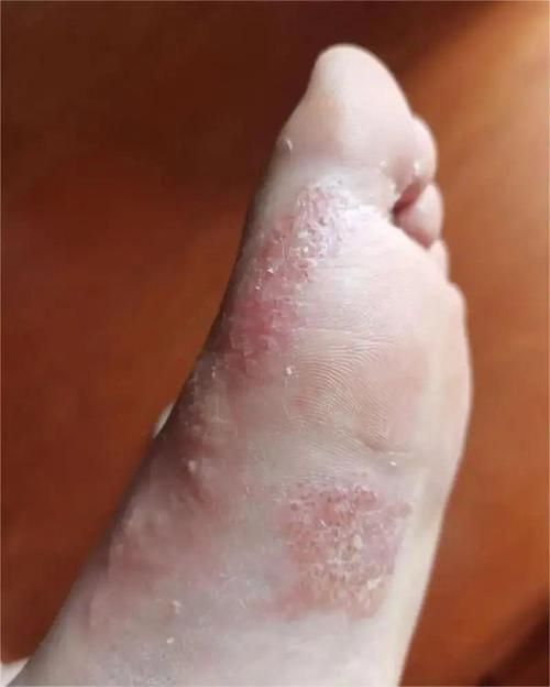 能否提供更多關(guān)于真菌和細(xì)菌的圖片,生物學(xué)研究中真菌和細(xì)菌的圖片生成的一段摘要:真菌和細(xì)菌 龍魚百科 第4張 能否提供更多關(guān)于真菌和細(xì)菌的圖片,生物學(xué)研究中真菌和細(xì)菌的圖片生成的一段摘要:真菌和細(xì)菌 能否提供更多關(guān)于真菌和細(xì)菌的圖片,生物學(xué)研究中真菌和細(xì)菌的圖片生成的一段摘要:真菌和細(xì)菌 龍魚百科 第4張