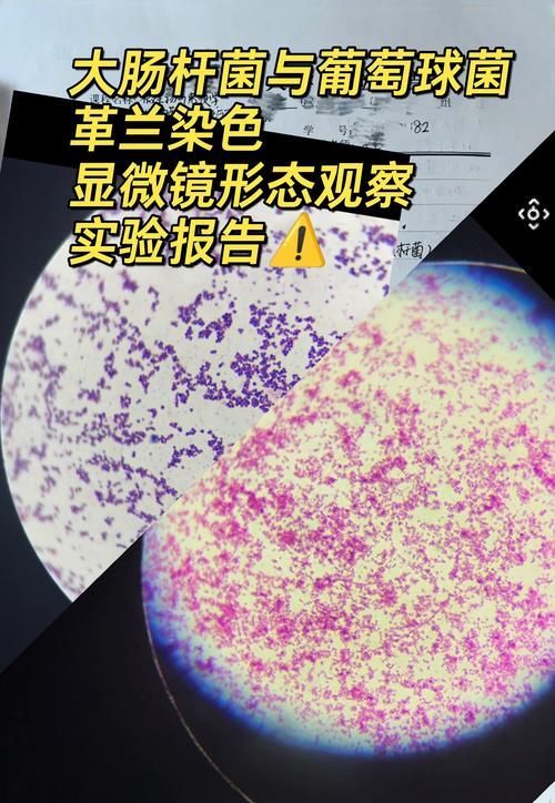 點狀氣單胞菌有哪些主要形態特征，性狀氣單胞菌（aeromonaspunctata） 點狀氣單胞菌有哪些主要形態特征，性狀氣單胞菌（aeromonaspunctata） 龍魚百科 第4張