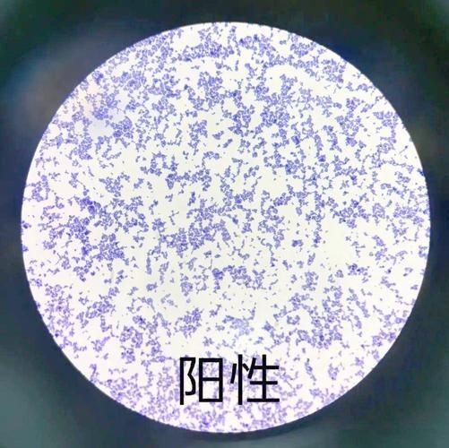 點狀氣單胞菌有哪些主要形態特征，性狀氣單胞菌（aeromonaspunctata） 點狀氣單胞菌有哪些主要形態特征，性狀氣單胞菌（aeromonaspunctata） 龍魚百科 第1張