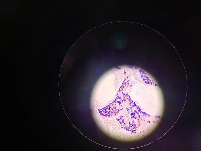 點狀氣單胞菌有哪些主要形態特征，性狀氣單胞菌（aeromonaspunctata） 點狀氣單胞菌有哪些主要形態特征，性狀氣單胞菌（aeromonaspunctata） 龍魚百科 第6張