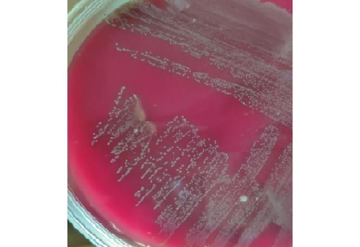 點狀氣單胞菌有哪些主要形態特征，性狀氣單胞菌（aeromonaspunctata） 點狀氣單胞菌有哪些主要形態特征，性狀氣單胞菌（aeromonaspunctata） 龍魚百科 第8張