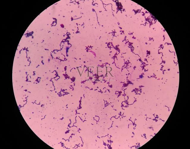 點狀氣單胞菌有哪些主要形態特征，性狀氣單胞菌（aeromonaspunctata） 點狀氣單胞菌有哪些主要形態特征，性狀氣單胞菌（aeromonaspunctata） 龍魚百科 第5張