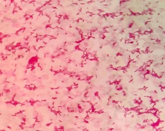 點狀氣單胞菌有哪些主要形態特征，性狀氣單胞菌（aeromonaspunctata） 點狀氣單胞菌有哪些主要形態特征，性狀氣單胞菌（aeromonaspunctata） 龍魚百科 第2張