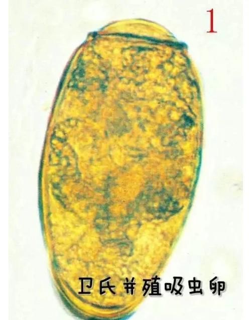 如何區分不同種類的魚虱，中戶要求1000字詳解如何區分不同種類的魚虱 如何區分不同種類的魚虱，中戶要求1000字詳解如何區分不同種類的魚虱 龍魚百科 第10張