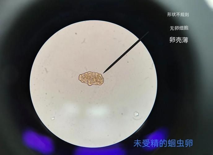 如何區分不同種類的魚虱，中戶要求1000字詳解如何區分不同種類的魚虱 如何區分不同種類的魚虱，中戶要求1000字詳解如何區分不同種類的魚虱 龍魚百科 第8張