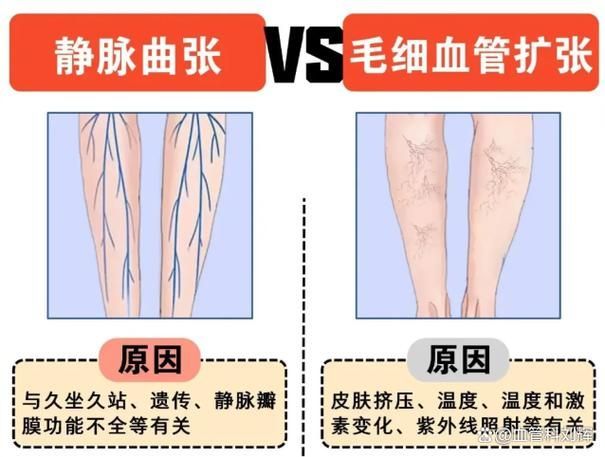 有沒有更多關于病理性膨脹的設定，“病理性膨脹”是什么意思？ 有沒有更多關于病理性膨脹的設定，“病理性膨脹”是什么意思？ 龍魚百科 第16張