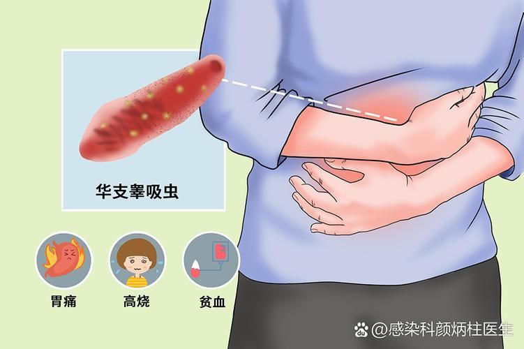 如何判斷自己是否感染了魚類寄生蟲,魚類寄生蟲感染 龍魚百科 第2張 如何判斷自己是否感染了魚類寄生蟲,魚類寄生蟲感染 如何判斷自己是否感染了魚類寄生蟲,魚類寄生蟲感染 龍魚百科 第2張