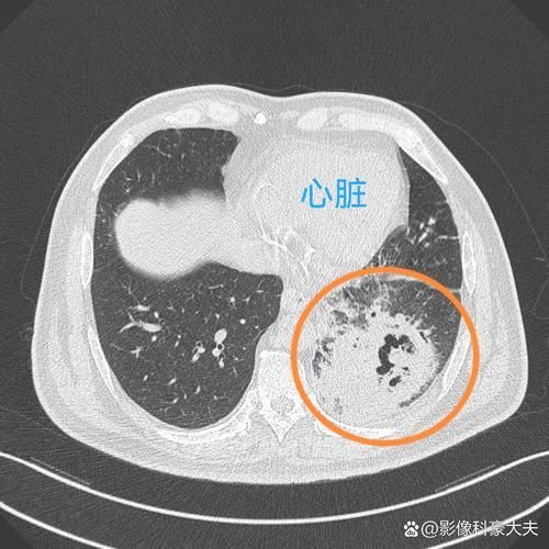 如何判斷自己是否感染了交叉病原體,交叉病原體感染指同一宿主同時(shí)或先后感染了交叉病原體 龍魚(yú)百科 第5張 如何判斷自己是否感染了交叉病原體,交叉病原體感染指同一宿主同時(shí)或先后感染了交叉病原體 如何判斷自己是否感染了交叉病原體,交叉病原體感染指同一宿主同時(shí)或先后感染了交叉病原體 龍魚(yú)百科 第5張