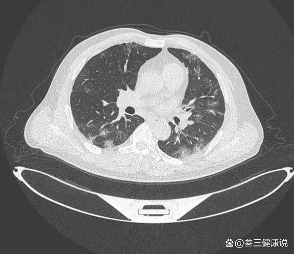 如何判斷自己是否感染了交叉病原體,交叉病原體感染指同一宿主同時(shí)或先后感染了交叉病原體 龍魚(yú)百科 第6張 如何判斷自己是否感染了交叉病原體,交叉病原體感染指同一宿主同時(shí)或先后感染了交叉病原體 如何判斷自己是否感染了交叉病原體,交叉病原體感染指同一宿主同時(shí)或先后感染了交叉病原體 龍魚(yú)百科 第6張