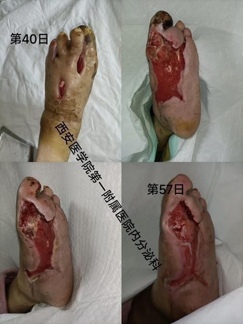 能提供更多潰爛病的圖片嗎,常見潰爛病的癥狀對比表 龍魚百科 第13張 能提供更多潰爛病的圖片嗎,常見潰爛病的癥狀對比表 能提供更多潰爛病的圖片嗎,常見潰爛病的癥狀對比表 龍魚百科 第13張
