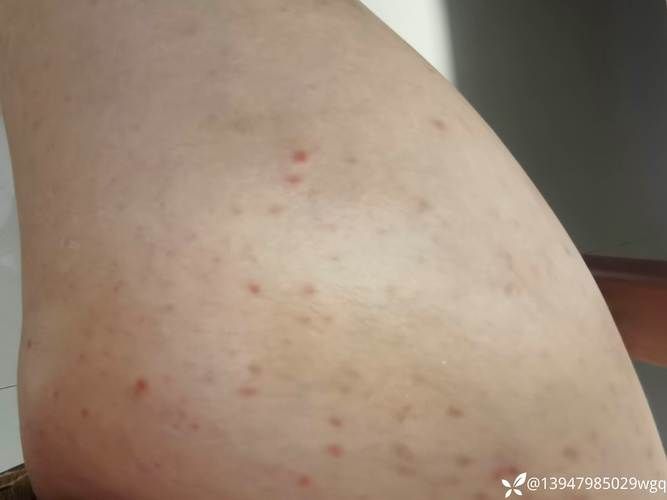 紅白錦鯉疾病如何治療？，關于紅白錦鯉疾病治療 紅白錦鯉疾病如何治療？，關于紅白錦鯉疾病治療 龍魚百科 第4張