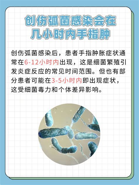 海洋弧菌感染早期圖片，關于海洋弧菌感染早期圖片的分析